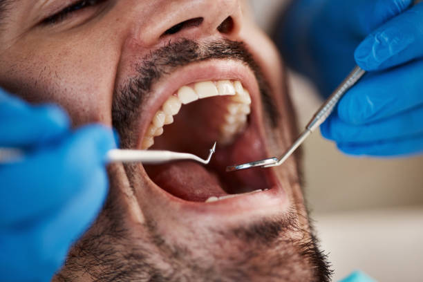 Best Laser Dentistry  in Clinton, OH